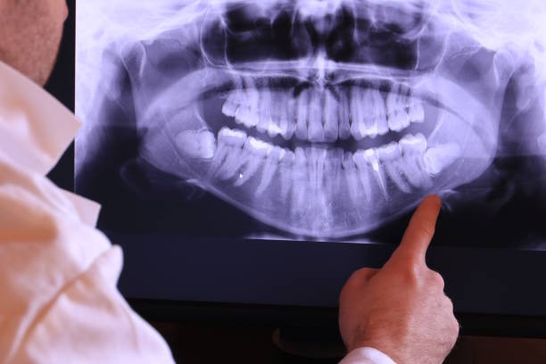 Best Broken Tooth Emergency  in Dane, WI