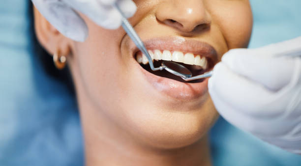 Best Dentist for Tooth Abscess  in Dane, WI